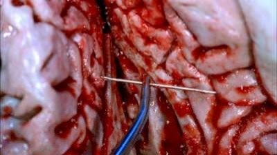 Сезон 4 Серия 4