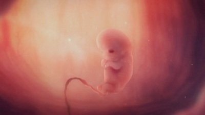 Сезон 1 Серия 79